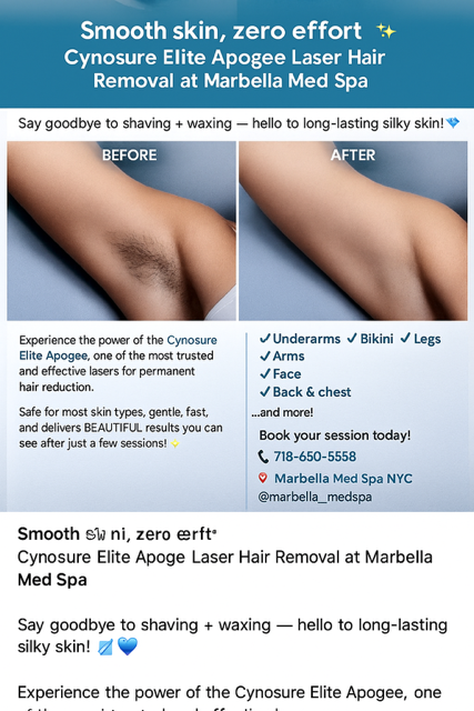Cynosure Elite Apogee Laser Hair Removal