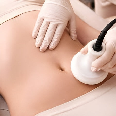 Cavitation