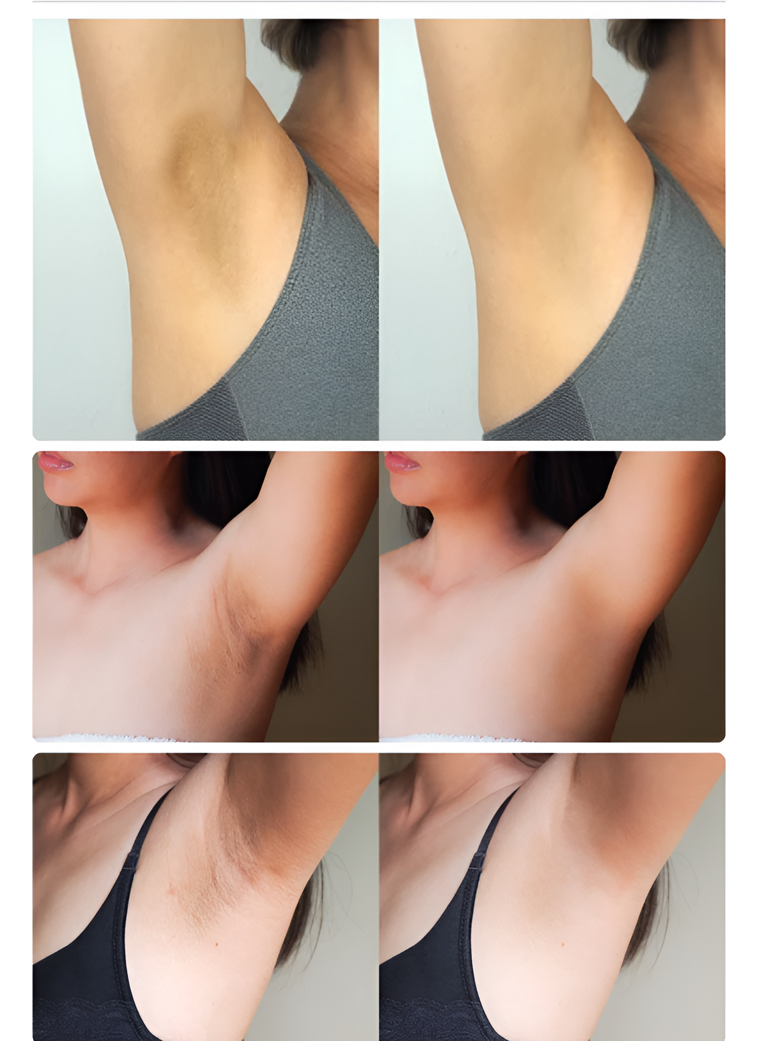 Bleaching
