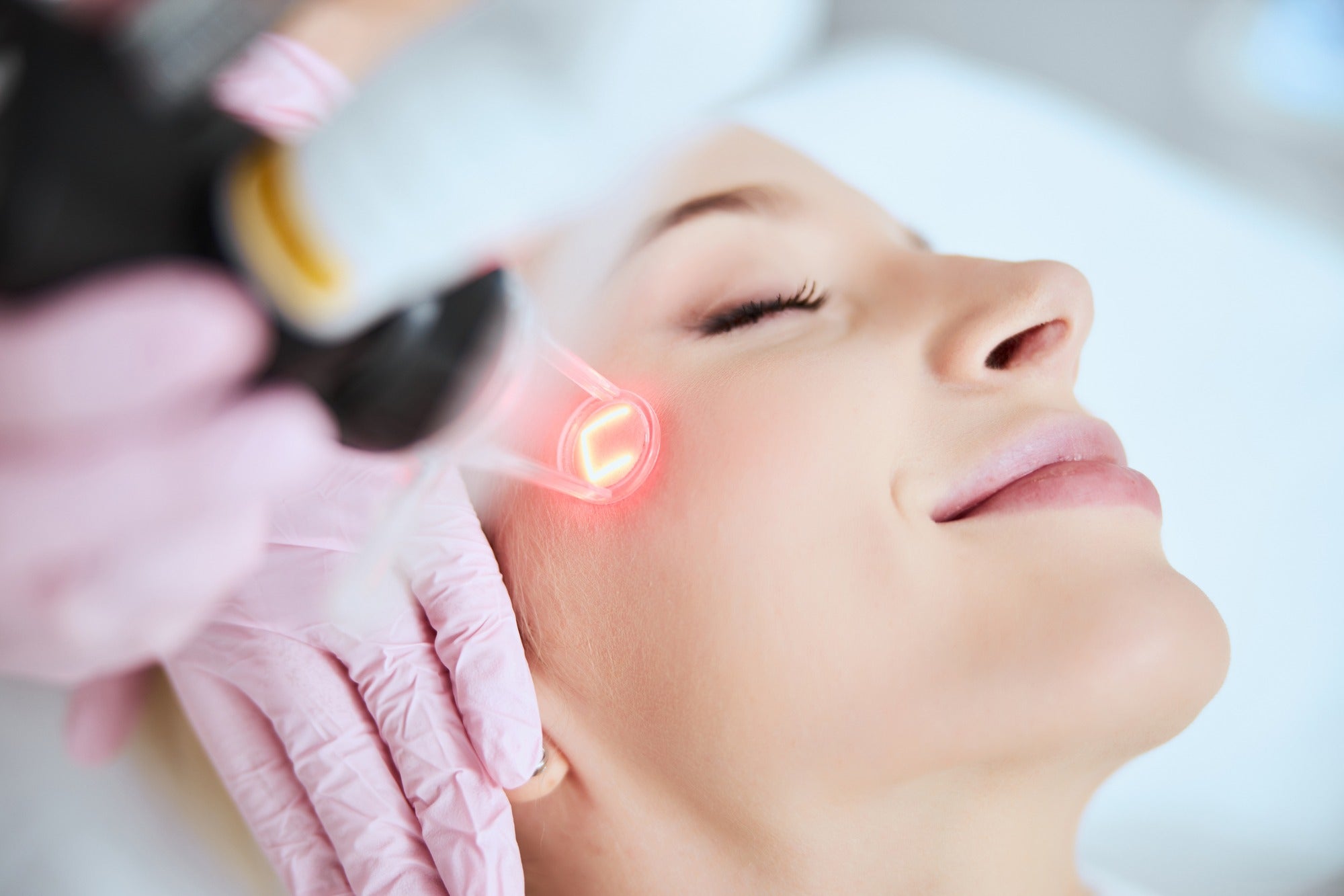Co2 fractional laser